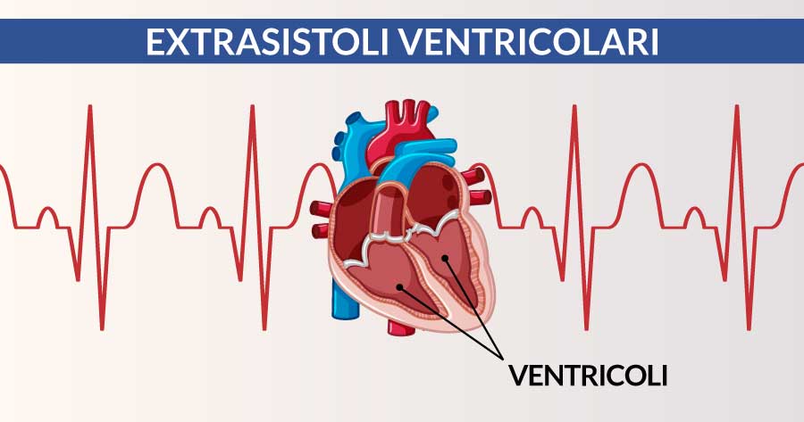 extrasistoli-ventricolari-cause-sintomi-e-diagnosi-cardiocenter-napoli