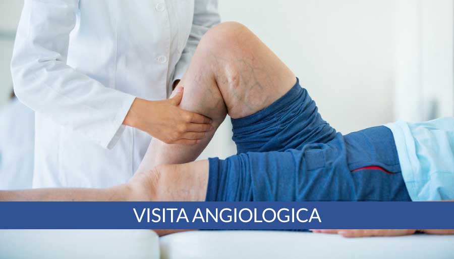 visita-angiologica-a-napoli-cardiocenter