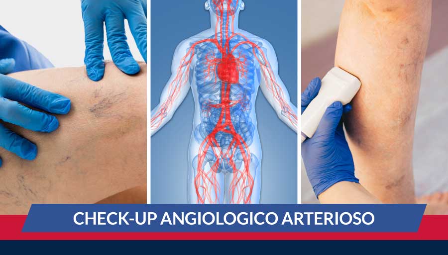 check-up-angiologico-arterioso-cardiocenter
