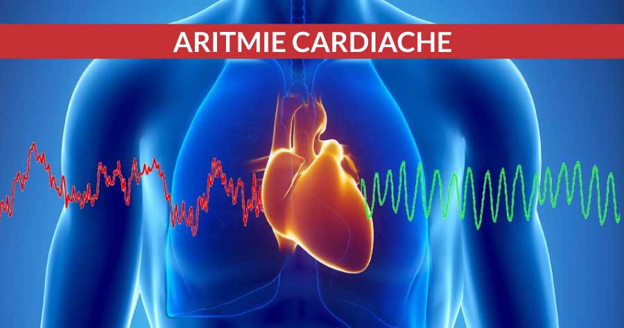 aritmie-cardiache-cosa-sono-napoli-cardiocenter