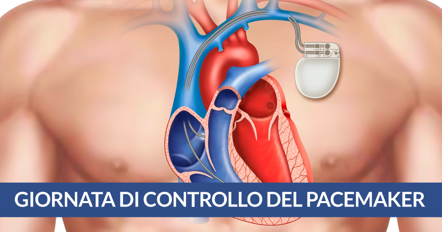 giornata-di-controllo-del-pacemaker-cardiocenter-napoli