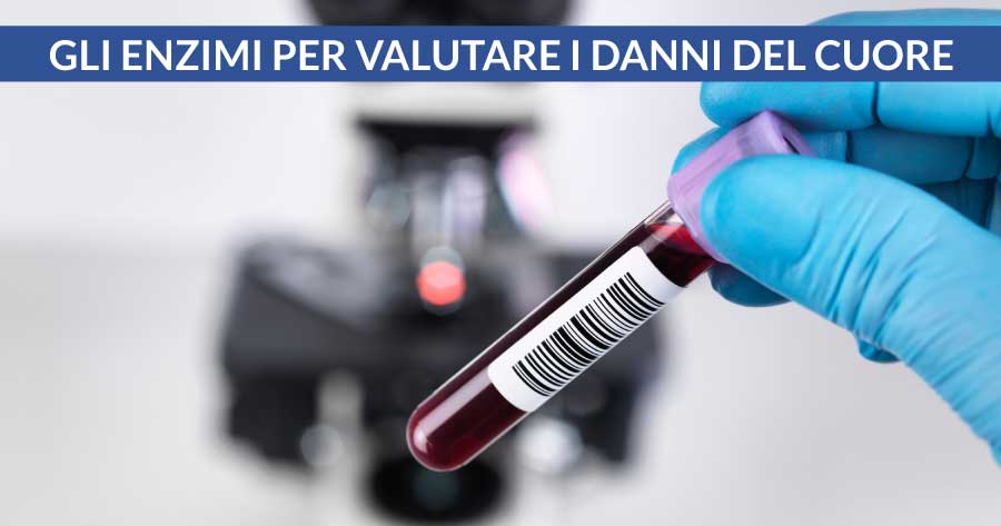 gli-enzimi-cardiaci-per-valutare-i-danni-del-cuore-cardiocenter