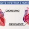 Endocardite infettiva e non infettiva, le differenze