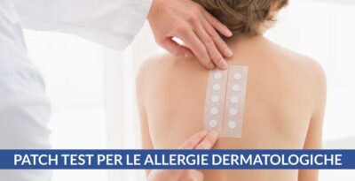 Patch test per le allergie dermatologiche