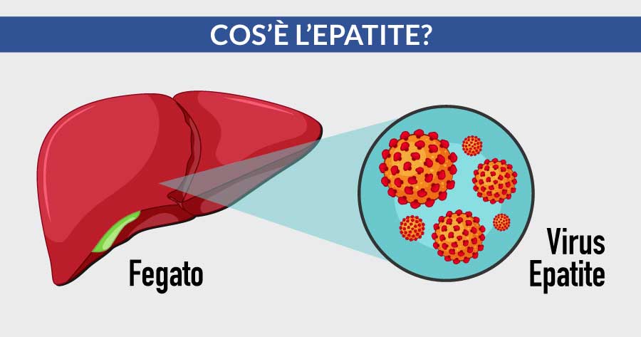 Cos'è l'epatite cardiocenter napoli