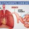Bronchite e Polmonite: come distinguerle