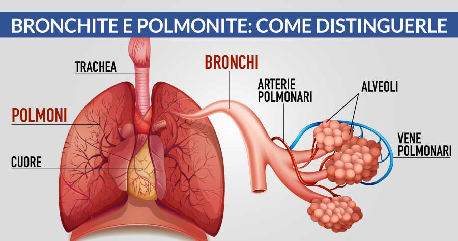 bronchite e polmonite come distinguerle cardiocenter