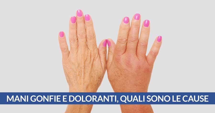 mani gonfie e doloranti cardiocenter napoli