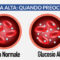Glicemia alta: quando preoccuparsi
