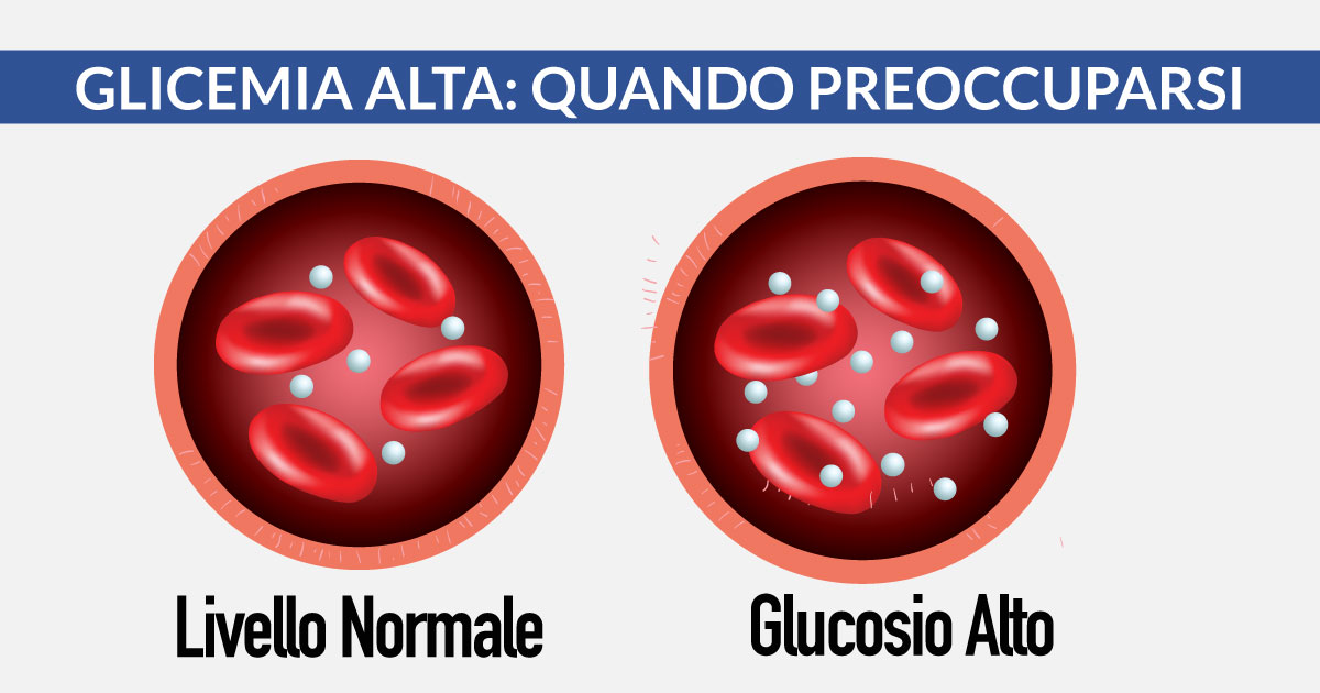 Glicemia-alta-quando-preoccuparsi-cardiocenter