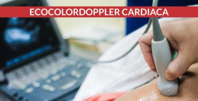 EcocolorDoppler cardiaco