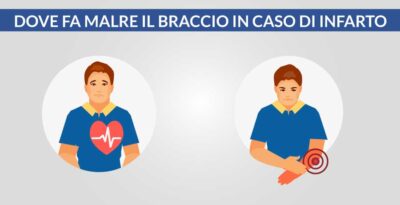 Dove fa male il braccio in caso di infarto?